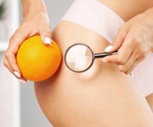 Ползваш ли тези ефективни техники за борба с целулита?