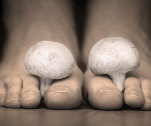 Упорити, по-упорити, най-упорити: гъбички по ноктите!